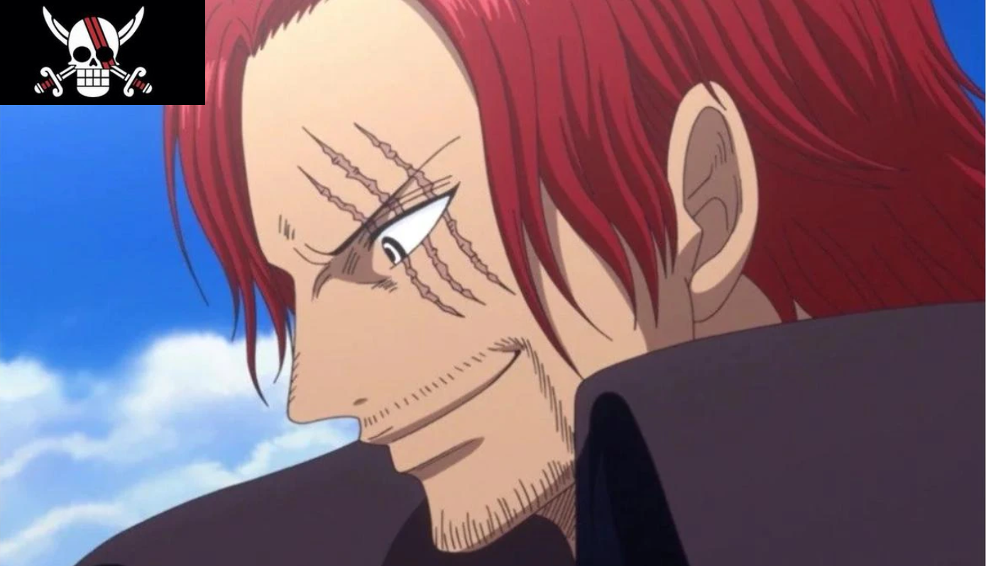 Shanks